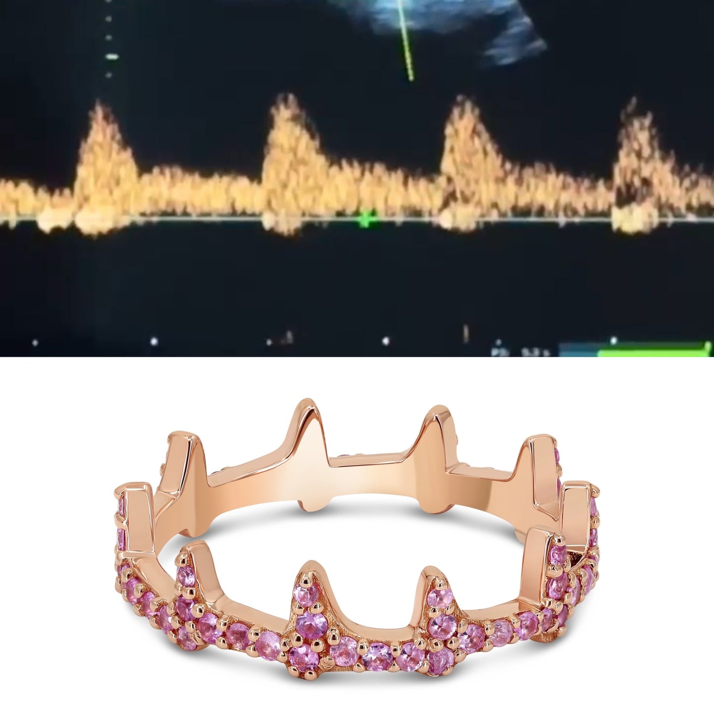 Heartbeat Ring